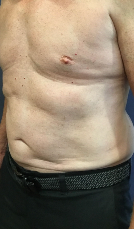 Roger's Chest Muscles Before His Transformation